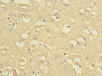 Immunohistochemistry (Formalin/PFA-fixed paraffin-embedded sections) - Anti-NISCH antibody (AB229970), expandable thumbnail