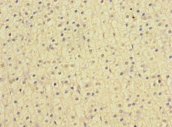 Immunohistochemistry (Formalin/PFA-fixed paraffin-embedded sections) - Anti-NISCH antibody (AB229970), expandable thumbnail