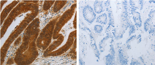 Immunohistochemistry (Formalin/PFA-fixed paraffin-embedded sections) - Anti-NIT2 antibody (AB183074), expandable thumbnail