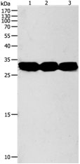 Western blot - Anti-NIT2 antibody (AB183074), expandable thumbnail