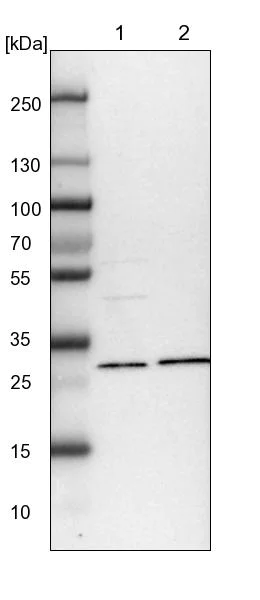 Western blot - Anti-NIT2 antibody (AB254759)