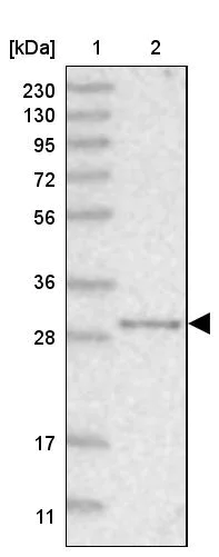 Western blot - Anti-NIT2 antibody (AB254759)