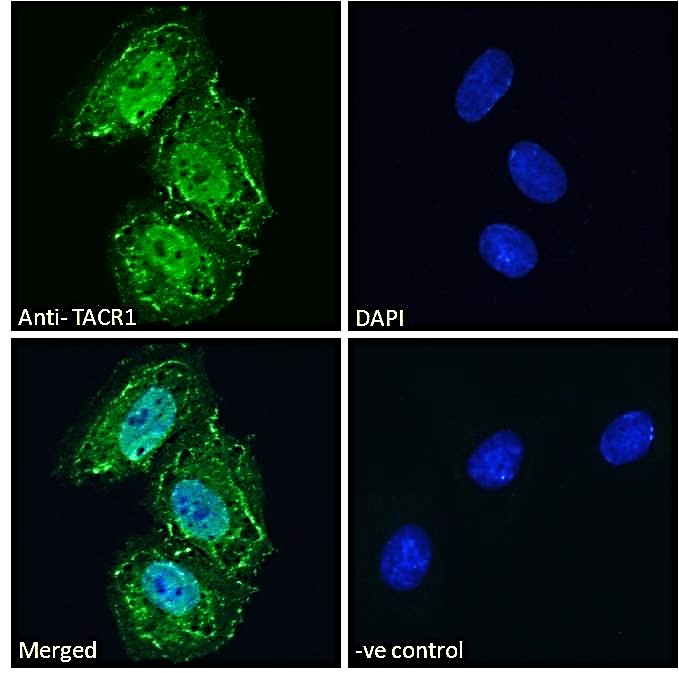 Immunocytochemistry/ Immunofluorescence - Anti-NK-1R antibody (AB61705), expandable thumbnail