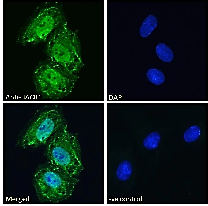 Immunocytochemistry/ Immunofluorescence - Anti-NK-1R antibody (AB61705)