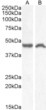 Western blot - Anti-NK-1R antibody (AB61705), expandable thumbnail