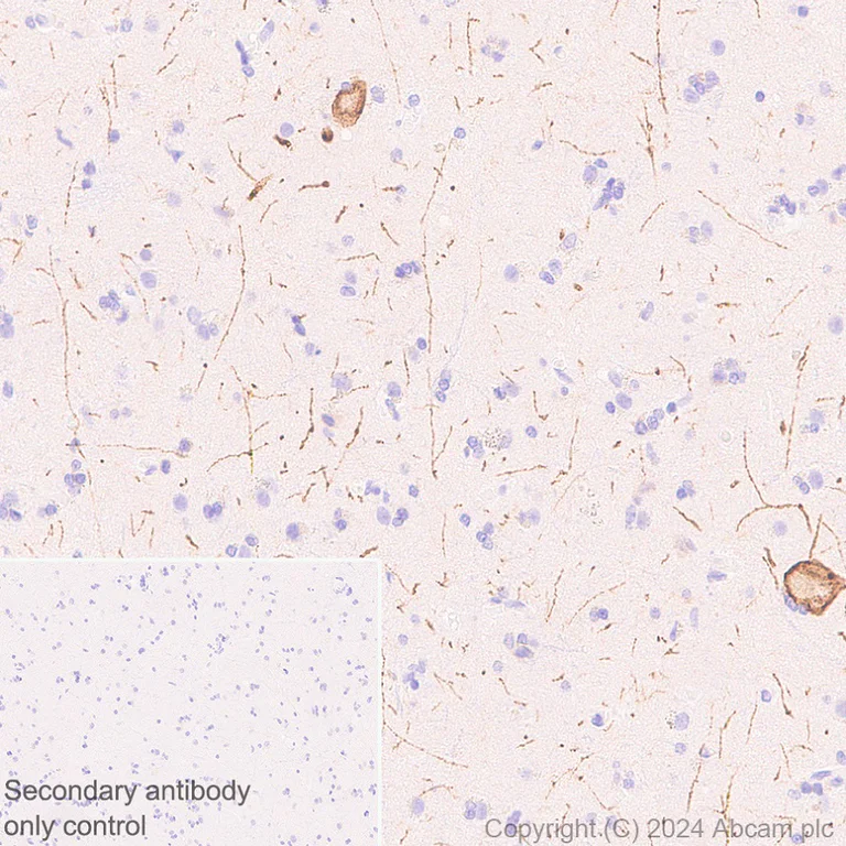 Immunohistochemistry (Formalin/PFA-fixed paraffin-embedded sections) - Anti-NK-1R antibody [EPR28834-27] (AB317504)