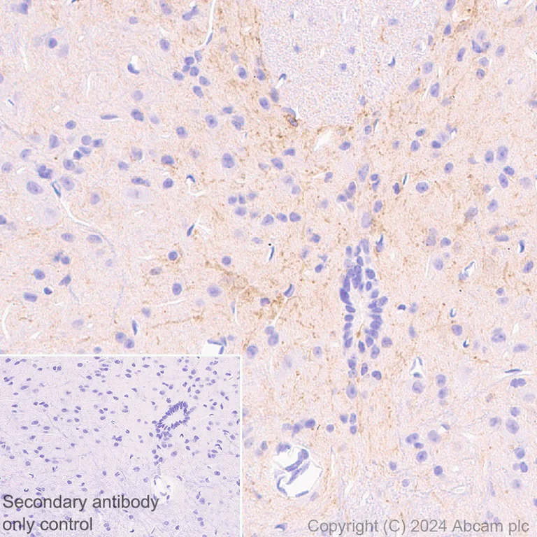 Immunohistochemistry (Formalin/PFA-fixed paraffin-embedded sections) - Anti-NK-1R antibody [EPR28834-27] (AB317504)