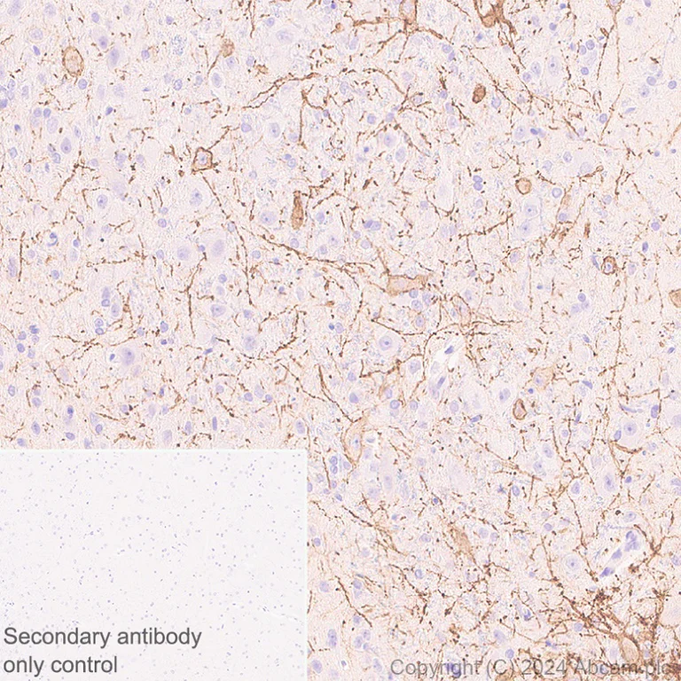 Immunohistochemistry (Formalin/PFA-fixed paraffin-embedded sections) - Anti-NK-1R antibody [EPR28834-27] (AB317504)