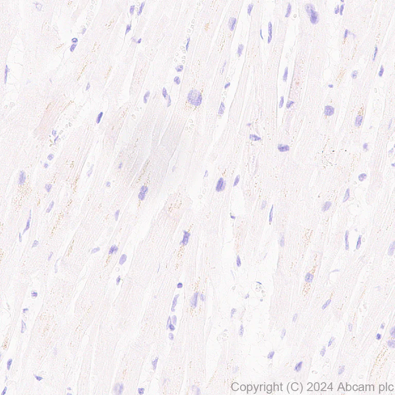 Immunohistochemistry (Formalin/PFA-fixed paraffin-embedded sections) - Anti-NK-1R antibody [EPR28834-27] (AB317504)