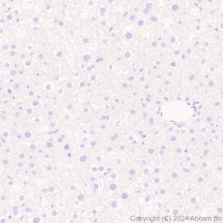 Immunohistochemistry (Formalin/PFA-fixed paraffin-embedded sections) - Anti-NK-1R antibody [EPR28834-27] (AB317504)