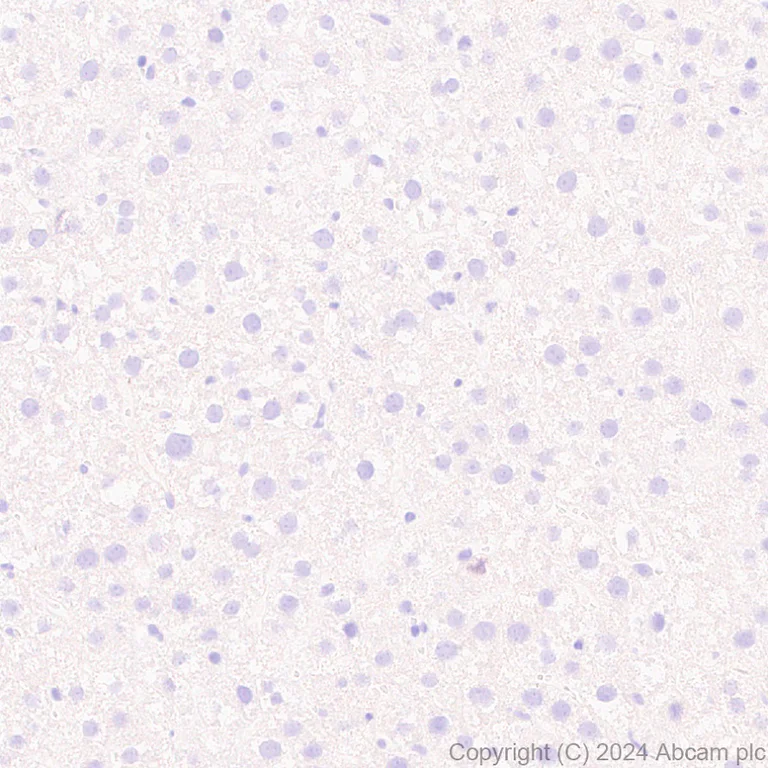 Immunohistochemistry (Formalin/PFA-fixed paraffin-embedded sections) - Anti-NK-1R antibody [EPR28834-27] (AB317504)