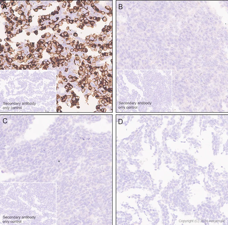 Immunohistochemistry (Formalin/PFA-fixed paraffin-embedded sections) - Anti-NK-1R antibody [EPR28834-27] (AB317504)