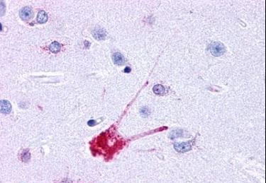 Immunohistochemistry (Formalin/PFA-fixed paraffin-embedded sections) - Anti-NK-1R antibody - Extracellular domain (AB219600)