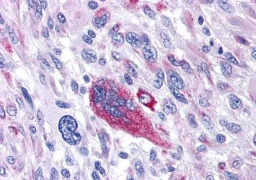 Immunohistochemistry (Formalin/PFA-fixed paraffin-embedded sections) - Anti-NK-1R antibody - Extracellular domain (AB219600)