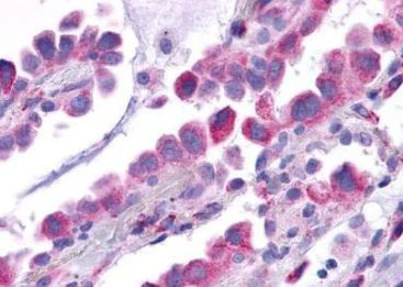 Immunohistochemistry (Formalin/PFA-fixed paraffin-embedded sections) - Anti-NK-1R antibody - Extracellular domain (AB219600)