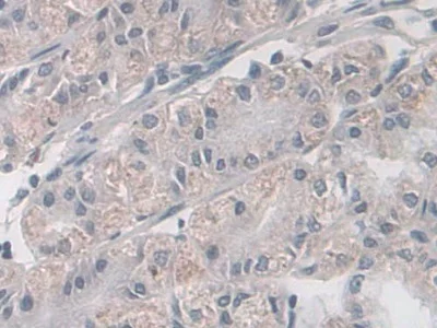 Immunohistochemistry (Formalin/PFA-fixed paraffin-embedded sections) - Anti-NK-2R antibody (AB233295)