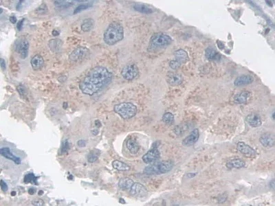 Immunohistochemistry (Formalin/PFA-fixed paraffin-embedded sections) - Anti-NK-2R antibody (AB233295)