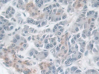 Immunohistochemistry (Formalin/PFA-fixed paraffin-embedded sections) - Anti-NK-2R antibody (AB233295)