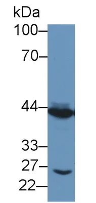 Western blot - Anti-NK-2R antibody (AB233295)