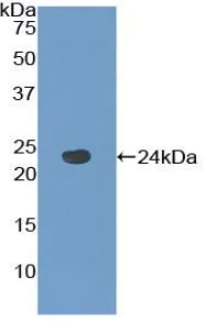 Western blot - Anti-NK-2R antibody (AB233295)
