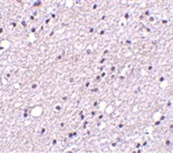 Immunohistochemistry (Formalin/PFA-fixed paraffin-embedded sections) - Anti-NK-3R antibody (AB124025)
