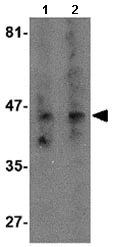 Western blot - Anti-NK-3R antibody (AB124025)