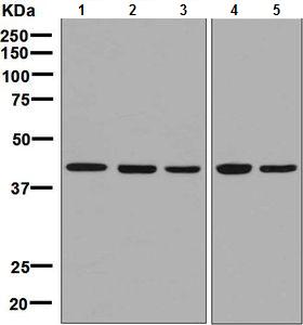 Western blot - Anti-NK-p44 antibody [EPR5060(2)] (AB133668), expandable thumbnail