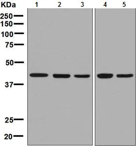 Western blot - Anti-NK-p44 antibody [EPR5060(2)] (AB133668)