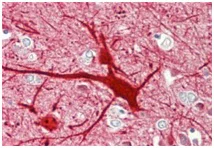 Immunohistochemistry (Formalin/PFA-fixed paraffin-embedded sections) - Anti-NKB antibody (AB191273)