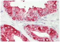 Immunohistochemistry (Formalin/PFA-fixed paraffin-embedded sections) - Anti-NKB antibody (AB191273)
