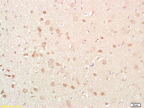 Immunohistochemistry (Formalin/PFA-fixed paraffin-embedded sections) - Anti-NKB antibody (AB203050), expandable thumbnail