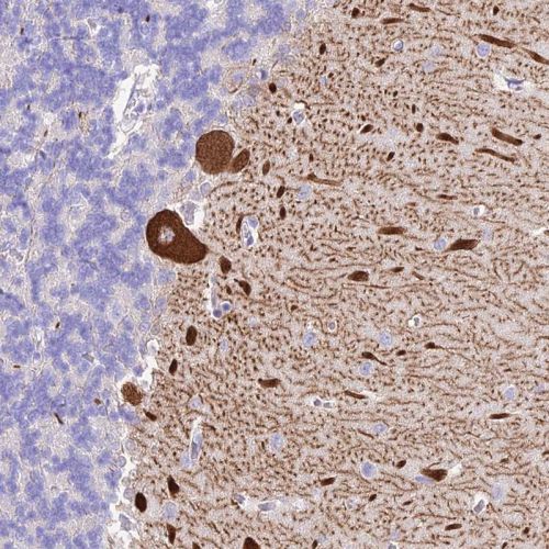 Immunohistochemistry (Formalin/PFA-fixed paraffin-embedded sections) - Anti-NKB antibody (AB244479), expandable thumbnail