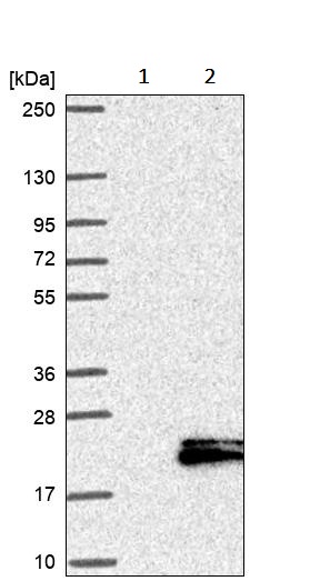 Western blot - Anti-NKB antibody (AB244479), expandable thumbnail