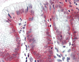 Immunohistochemistry (Formalin/PFA-fixed paraffin-embedded sections) - Anti-NKCC1 antibody (AB140986)