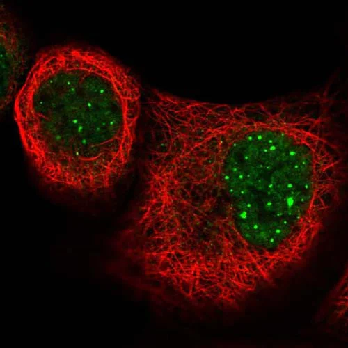 Immunocytochemistry/ Immunofluorescence - Anti-NKF3 kinase family member/PEAK1 antibody (AB121865)