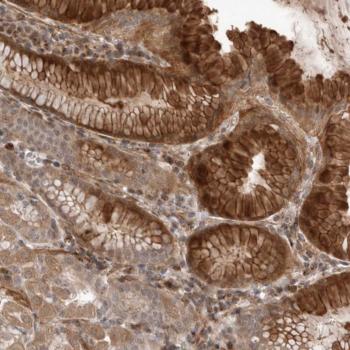 Immunohistochemistry (Formalin/PFA-fixed paraffin-embedded sections) - Anti-NKF3 kinase family member/PEAK1 antibody (AB121865)