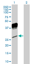 Western blot - Anti-NKG2A antibody (AB169285), expandable thumbnail