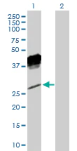 Western blot - Anti-NKG2A antibody (AB169285)