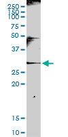 Western blot - Anti-NKG2A antibody (AB169285), expandable thumbnail