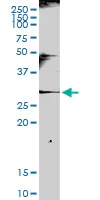 Western blot - Anti-NKG2A antibody (AB169285)