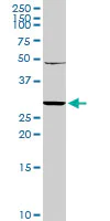 Western blot - Anti-NKG2A antibody (AB169285)