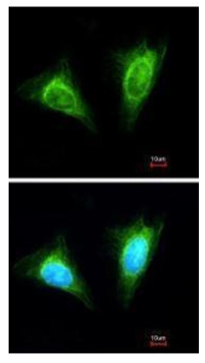 Immunocytochemistry/ Immunofluorescence - Anti-NKG2A antibody (AB96319)