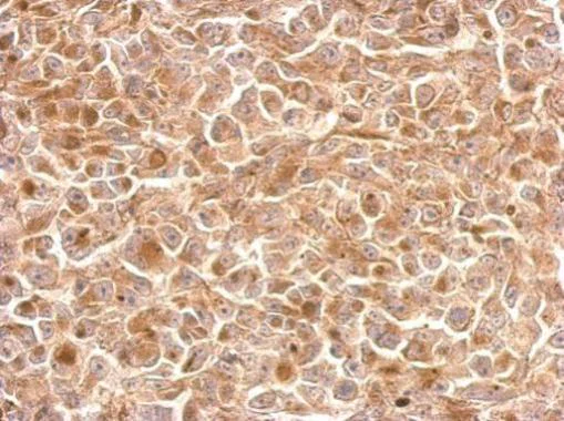 Immunohistochemistry (Formalin/PFA-fixed paraffin-embedded sections) - Anti-NKG2A antibody (AB96319)