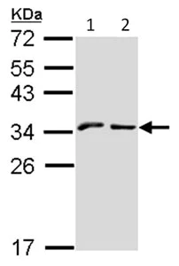 Western blot - Anti-NKG2A antibody (AB96319)