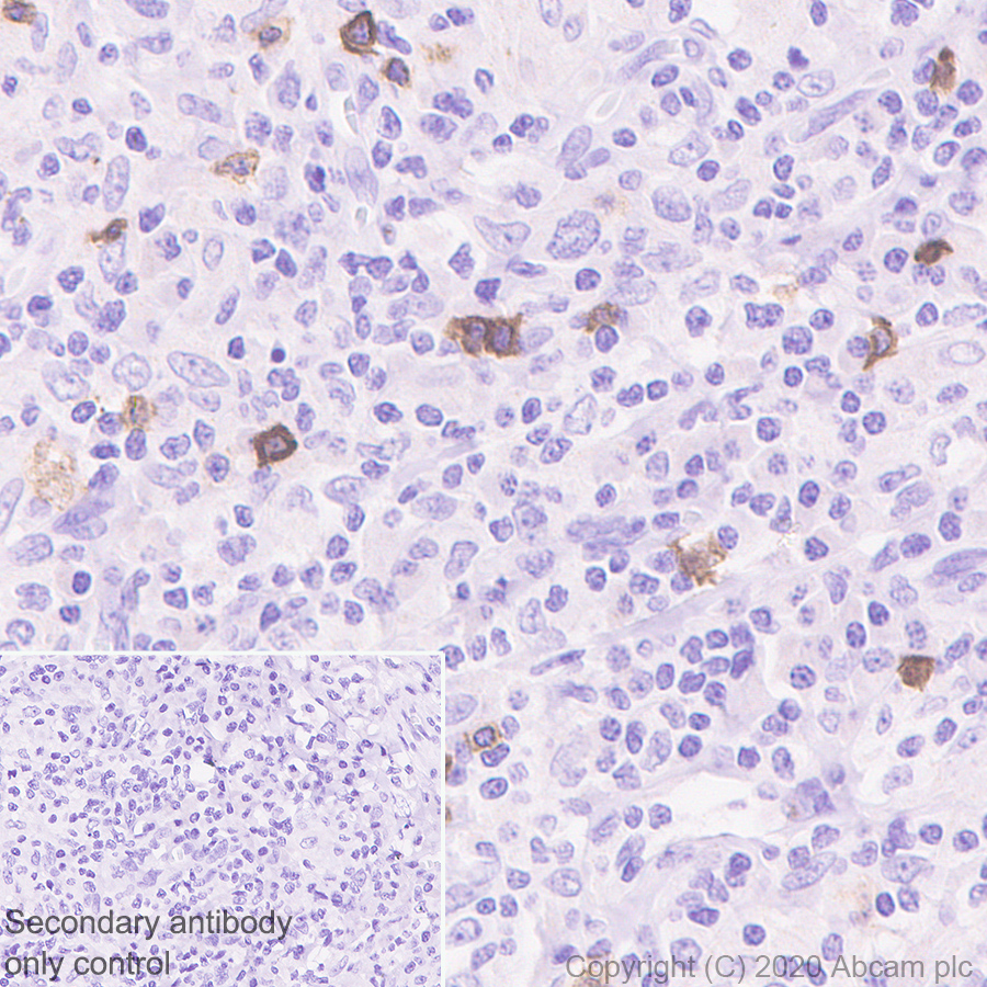 Immunohistochemistry (Formalin/PFA-fixed paraffin-embedded sections) - Anti-NKG2A antibody [EPR23737-127] (AB260035), expandable thumbnail