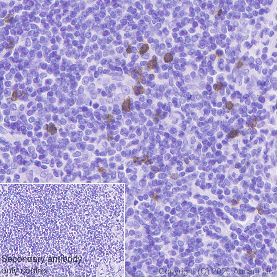 Immunohistochemistry (Formalin/PFA-fixed paraffin-embedded sections) - Anti-NKG2A antibody [EPR23737-127] (ab260035), expandable thumbnail