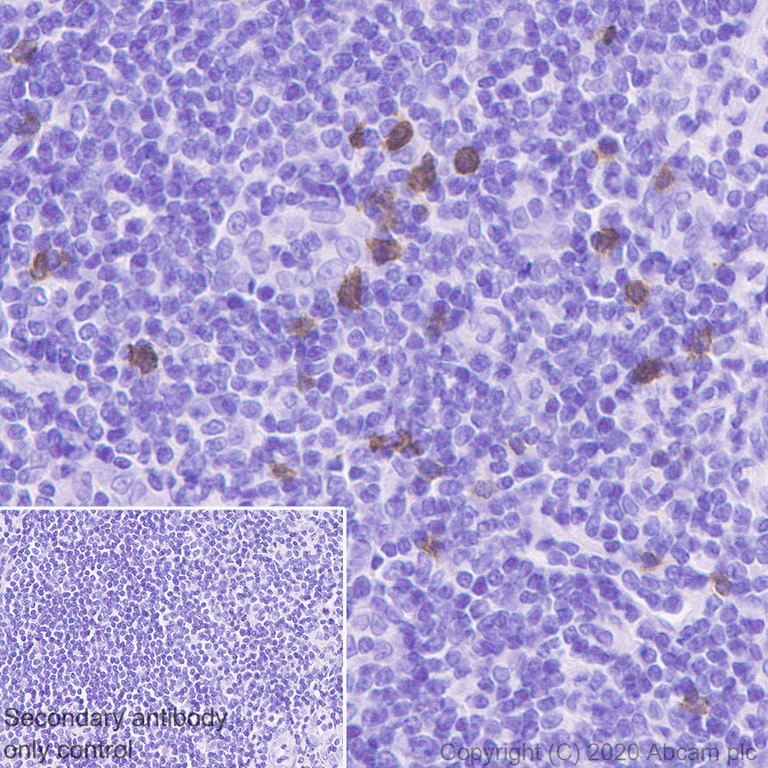 Immunohistochemistry (Formalin/PFA-fixed paraffin-embedded sections) - Anti-NKG2A antibody [EPR23737-127] (AB260035)