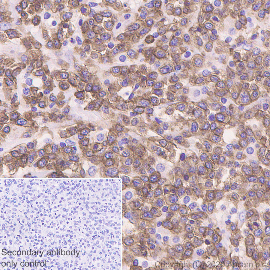 Immunohistochemistry (Formalin/PFA-fixed paraffin-embedded sections) - Anti-NKG2A antibody [EPR23737-127] (AB260035), expandable thumbnail