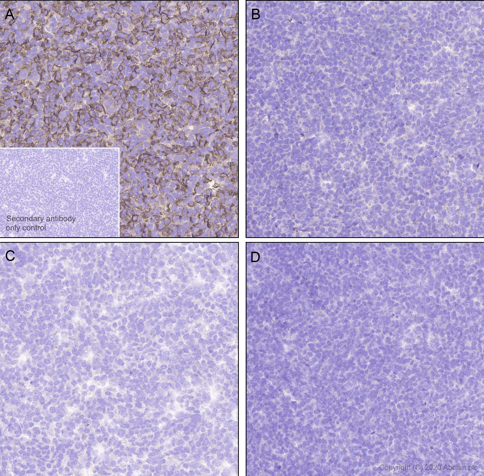 Immunohistochemistry (Formalin/PFA-fixed paraffin-embedded sections) - Anti-NKG2A antibody [EPR23737-127] (AB260035), expandable thumbnail
