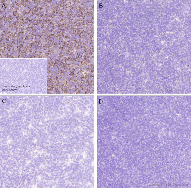 Immunohistochemistry (Formalin/PFA-fixed paraffin-embedded sections) - Anti-NKG2A antibody [EPR23737-127] (AB260035)